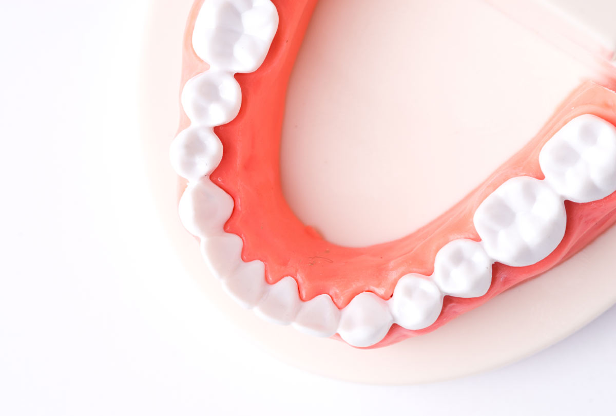A row of dentures pictured from above with the words "3 Reasons You Need Gum Gel"