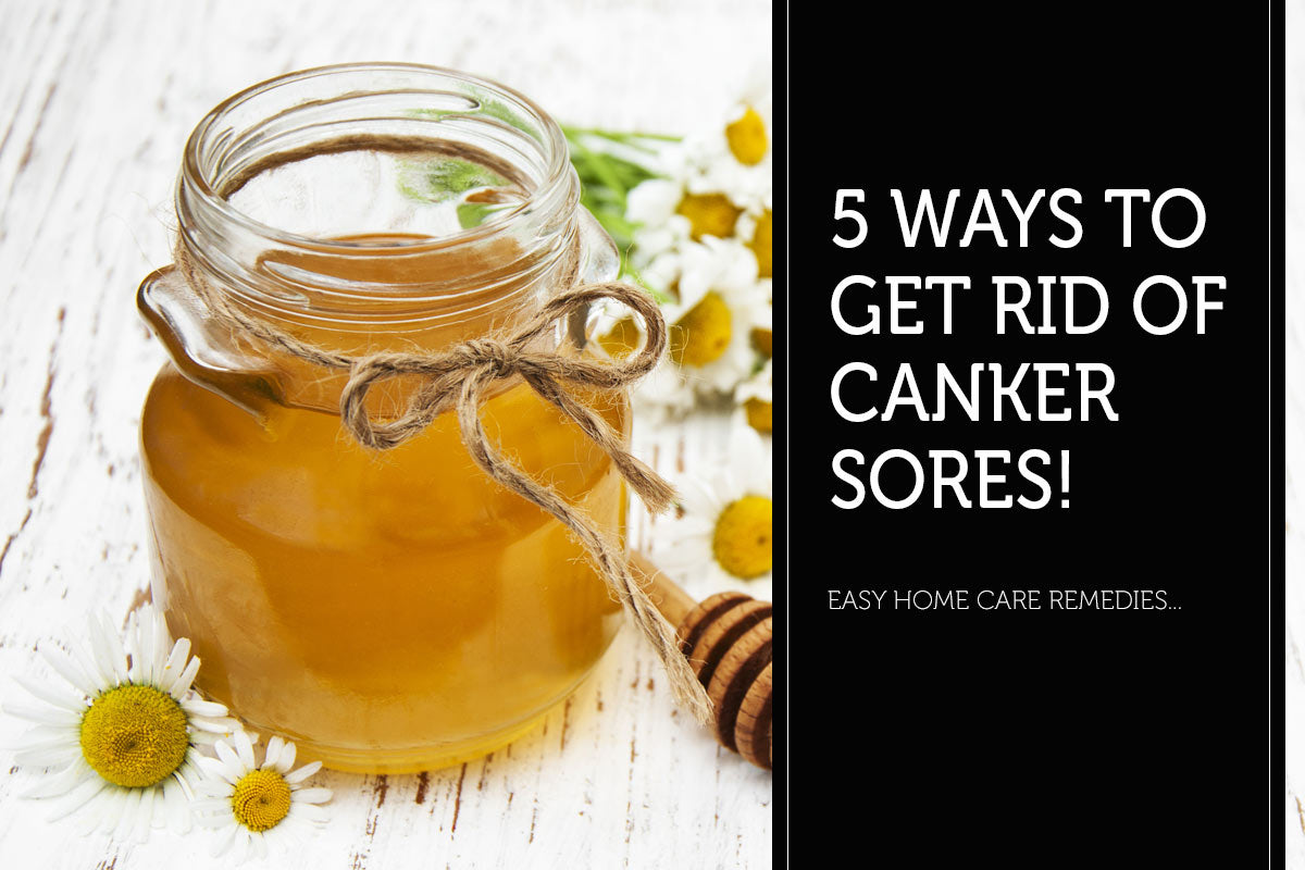 5 Ways to Get Rid of Canker Sores